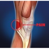 7 mths of knee pain GONE!
